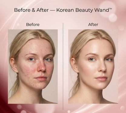 Korean Beauty Wand™